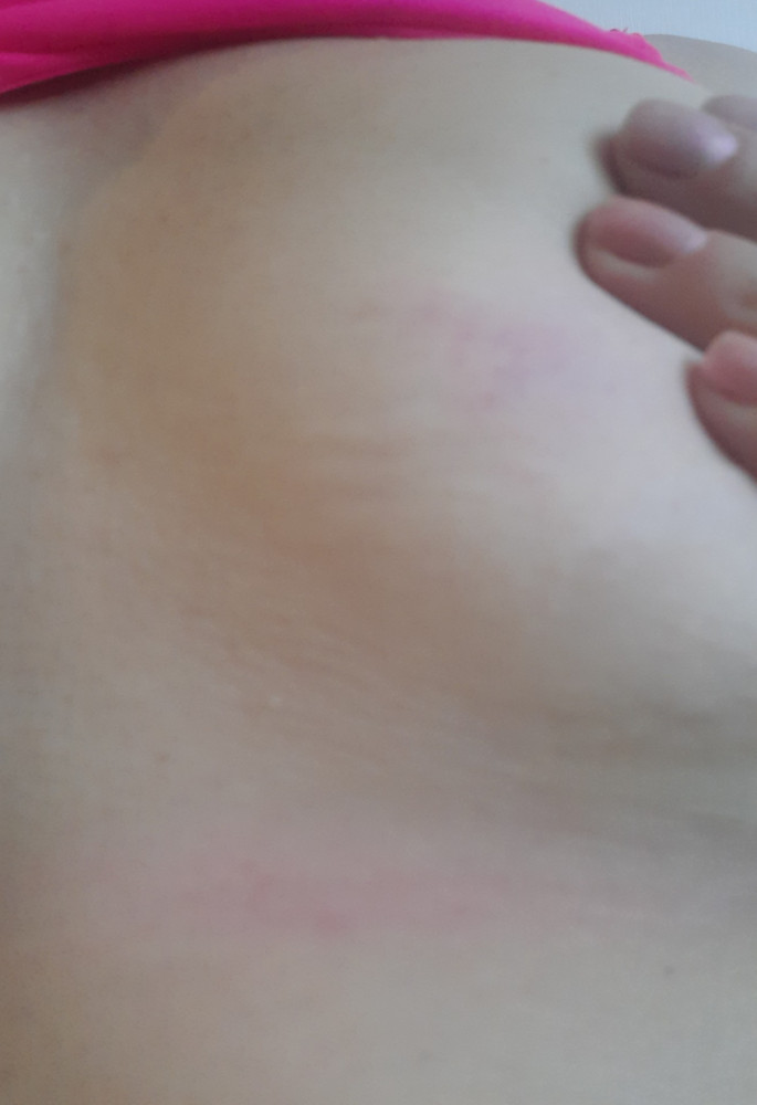 Получив комплект была в восторге. По размеру все подошло. Материал мягкий, к телу приятный. 
Вещи сразу перестирываю после пркупки., при стирке в прохладной воде вода немного окрасилась, но это было ожидаемо. 
Первый раз надела топ в длительную велопоездку, вечером обнаружила что он весь в фиолетовых разводах и в некоторых местах под ним моя кожа окрасидась в ярко розовый ( поездка была интенсивной, потели много). Перестирала снова согласно инструкции.
Сегодня надела топ на zumbu,  опять же интенсив и пот и снова обнаруживаю разводы цветовые на топе и окрашеную кожу.
Мне кажется после нескольких стирок такая линька не нормально! Не знаю чем окрашивают белье, очень надеюсь что с меня кожа не слезит. Брала белье для удобства, но в итоге как пользоваться вечно линяющим бельем - не понятно!