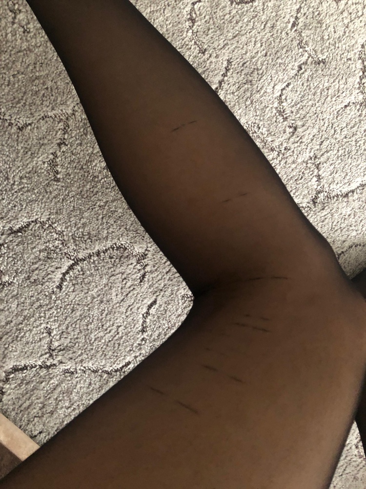 Чулки пришли в затяжках,качество ужасное👎