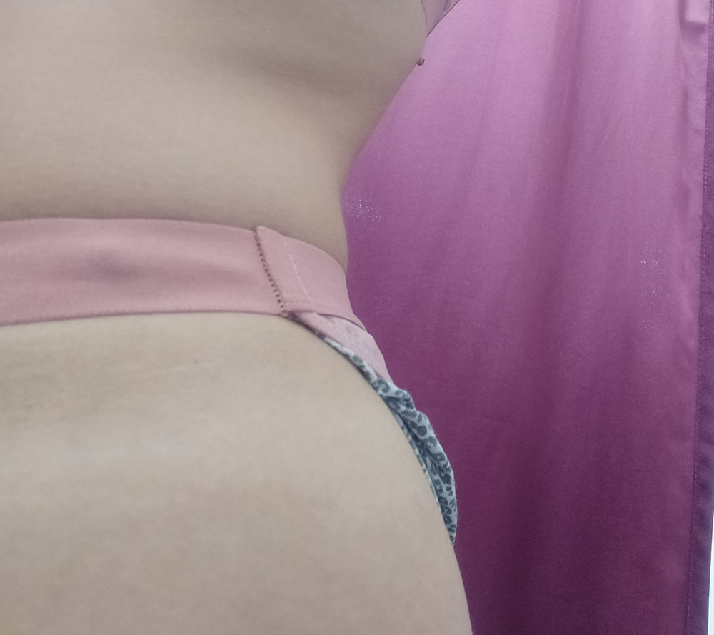 В целом комплект неплохой, но очень не понравился шов с одной стороны на трусах на резинке , весь вид портит, поэтому отказ