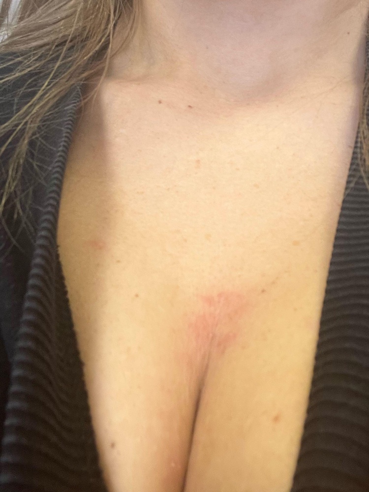 Странно,что написано гипоаллергенный,через два дня активной носки как раз аллергия и проявилась.Само изделие действительно красивое,пришло целое и выглядит как на фото