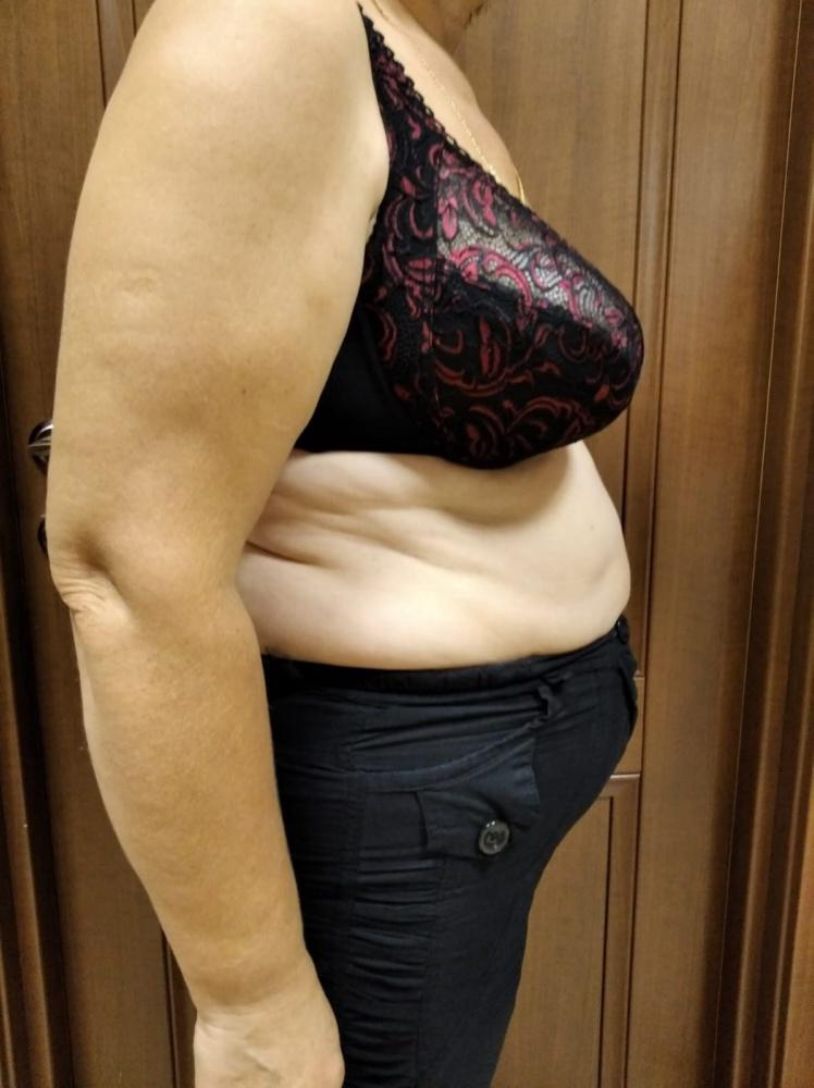 Прекрасная вещь! Почему я о ней не знала раньше? Фото говорят сами за себя, очень довольна! Надеть не составило труда, инструкция в помощь. Качество отличное!