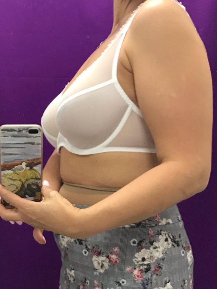 Отличный бюстгальтер ))) рекомендую!! выбирала из 90с и 85е так как на было 85д. В итоге лучше села меньшая чашка С. Качество отличное, вскипает я люблю. Жаль трусики были маловаты без возможности замены размера. Спасибо магазину!!!