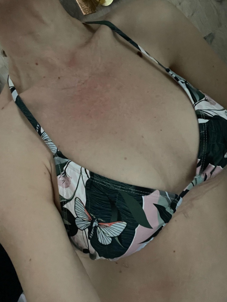 Великолепный лиф!!! Очень надеялась именно на наличие стрекозок))) на объём груди 88 М сел идеально, вкладыши убрала, мне показались лишние. Прекрасный вариант для пляжа и загара. 