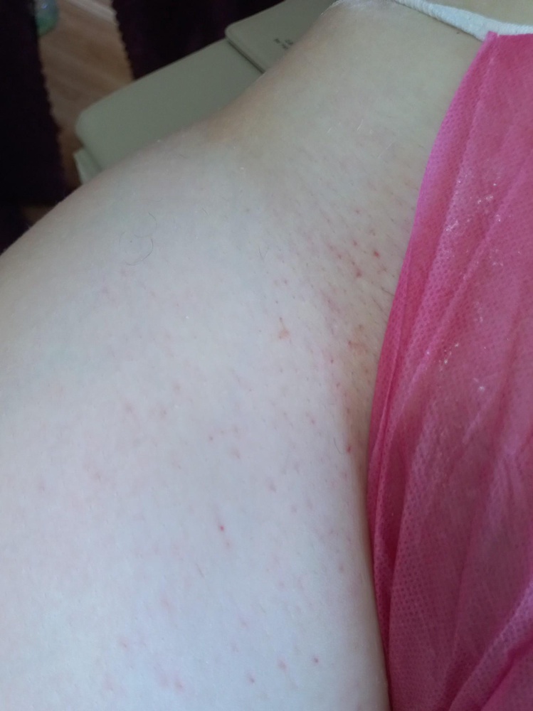 Отличные трусики для депиляции  зоны классического бикини. Всё трусики в индивидуальной  упаковке. Продавца рекомендую.