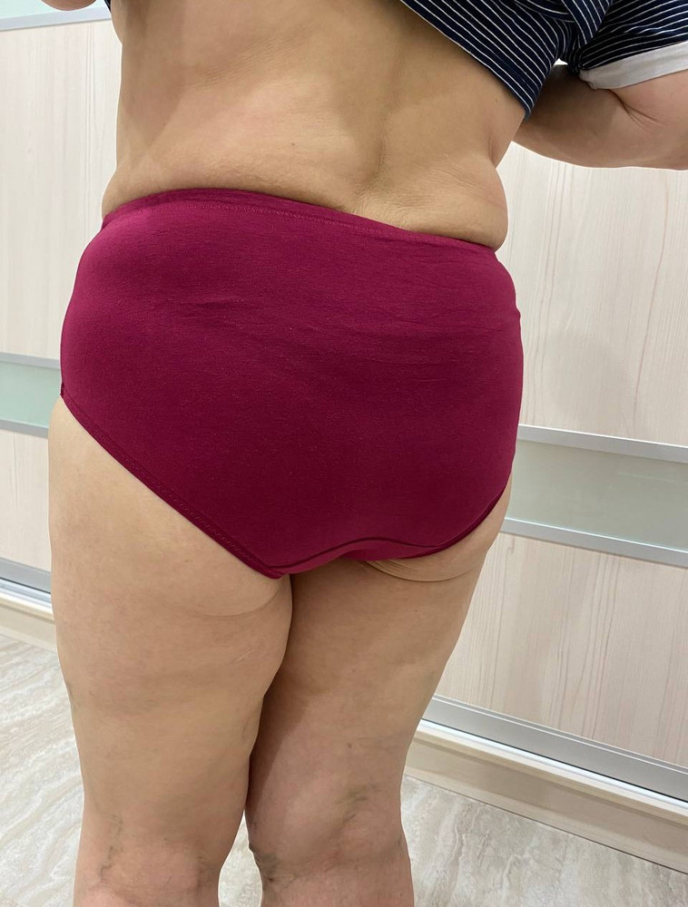 Пришли быстро. Упакованы в прозрачный пакет. Качество трусов отличное. На мой 50-52 взяла XXXL, размер подошёл. Ткань приятная. Швы аккуратные, нитки не торчат. Резинка очень порадовала.