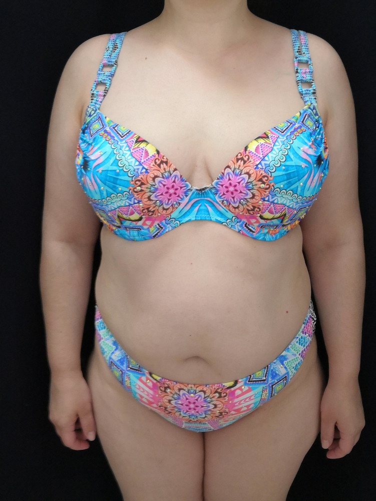 Купальник очень качественный. Идеально сел на бедра 110 см и грудь 90С. Чашка немного маломерит, как мне показалось. Но село отлично, ничего нигде не вылазит по бокам, все лишнее закрыто. Ткань очень приятная на ощупь, тонкая и эластичная. Пр качеству сравнимо с купальниками Magistral. 