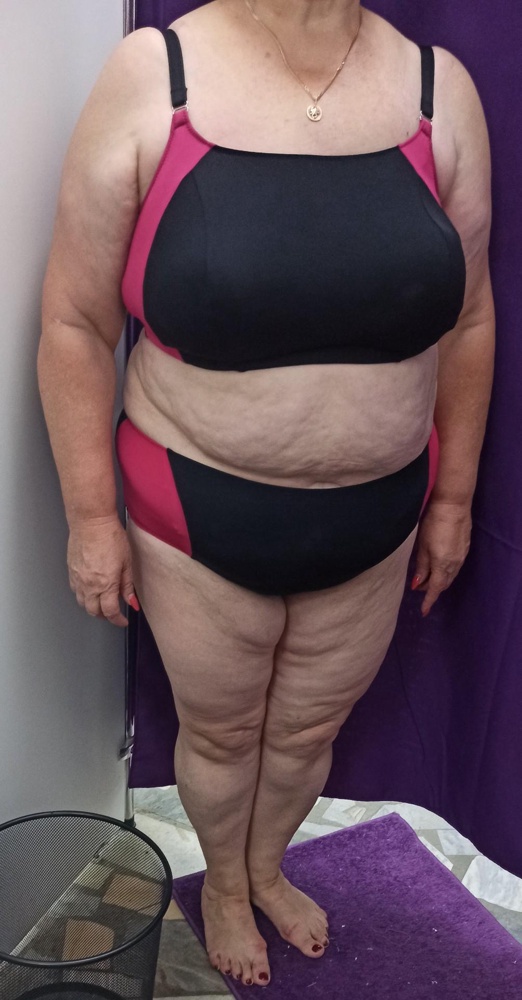 Бал снижаю за пластмассовую застежку! Ортопедические вещи должны быть, по моему,  более продуманными и комфортными! Ткань, по сравнению с другими купальниками этого же производителя, действительно тоньше. Может именно поэтому тянется лучше и сел на фигуру 56-58 размера. За счёт цветных вставок купальник смотрится нескучно.