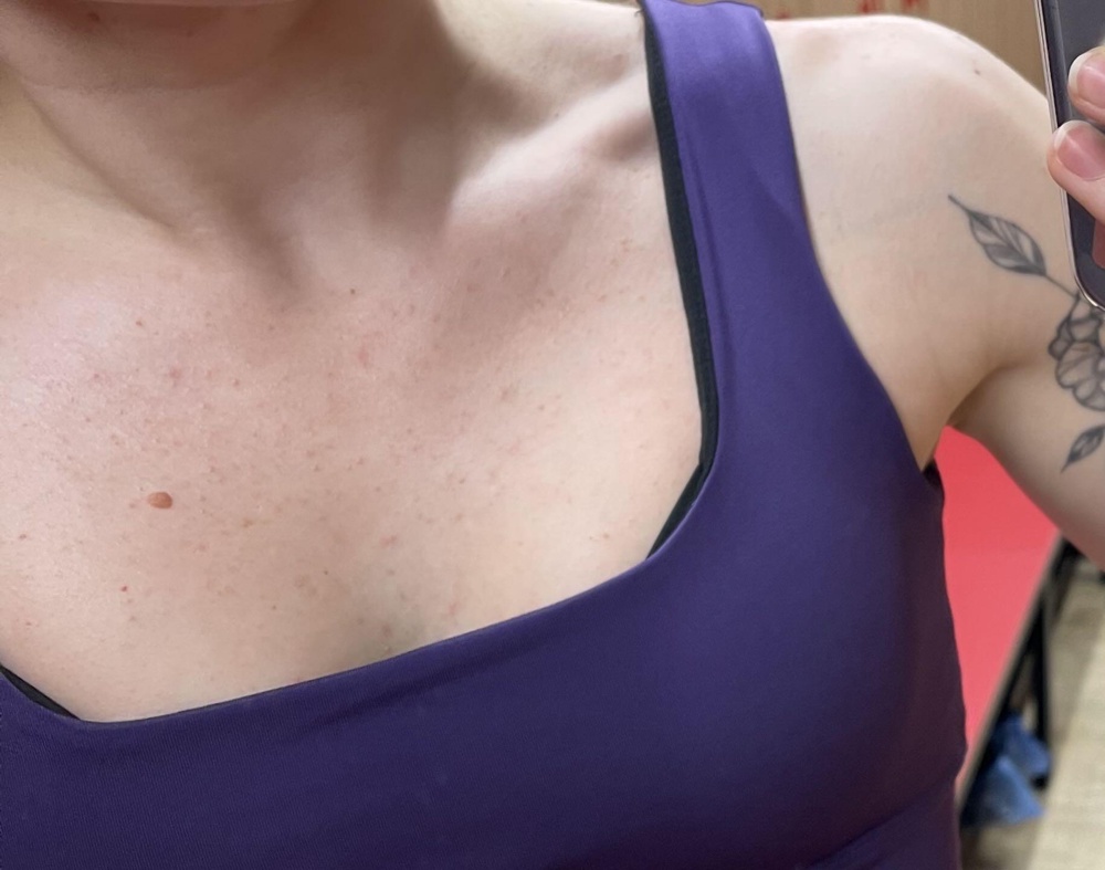 Разачоравалась. Покупала уже у этой фирмы велосипедки, топ, раш и была в восторге. Этот комплект разочаровал полностью. На второй раз (!!) уже появились катышки на лосинах, а топ может быть изначально бракованный был не знаю даже, но с правой стороны постоянно лямка загибается и подкладка чёрная торчит, с левой стороны не так сильно, а с правой очень бесит. Расстроена в общем((( И, кстати, если вы на тренировке вспотели - это будет видно. А так как мои тренировки всегда с высокой нагрузкой и потоотделение в подобном случае вполне ожидаемо, то даже не знаю куда теперь его носить. В общем по дизайну очень нравится, а вот по качеству совсем плохо 