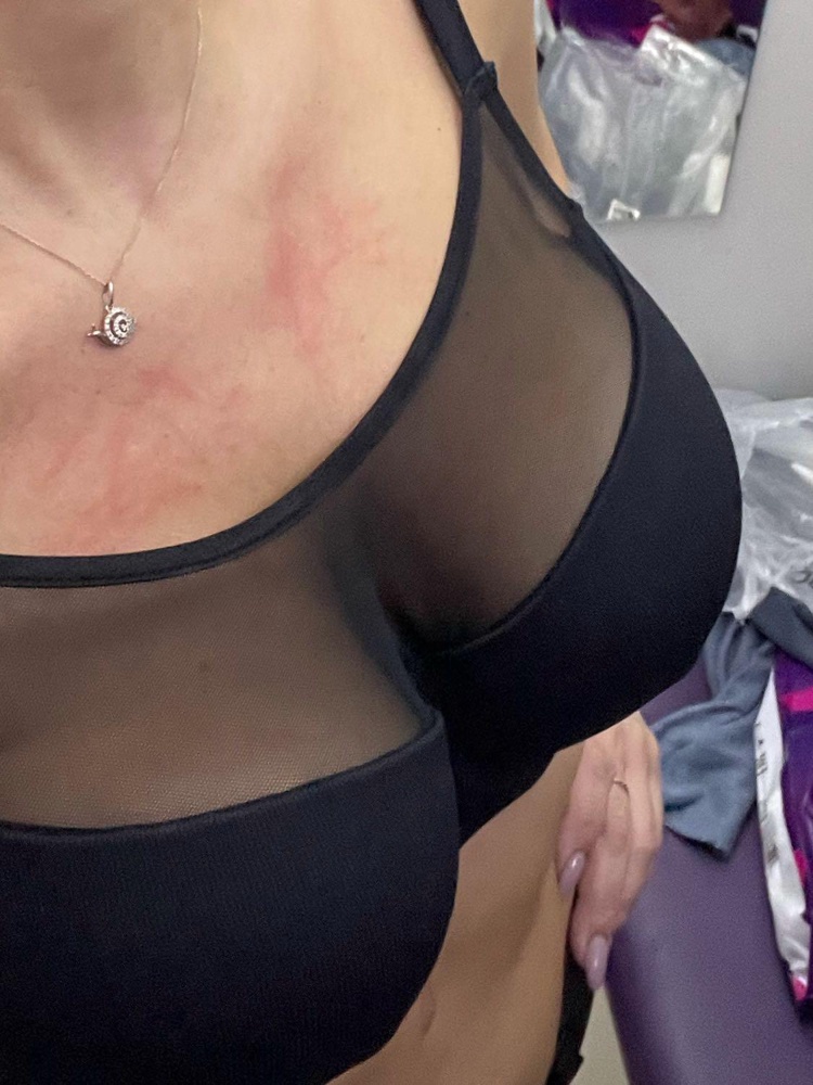 Задумка хорошая но исполнение на тройку. В самом видном месте сетка пришита с браком, сильно сборит что портит весь вид купальника.