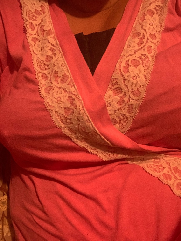 Одели после операции) Редуктивная маммопластика. Операция сложная для тех кто вдруг не знает. Этот бюстгальтер считаю очень удобным. Мой пластический хирург тоже считает его удачным. Прежде чем купить советовалась с доктором. Тело в нём дышит. Для меня всё удобно. Но! Жать, что утягивающая резинка всё же не снимается. Потом можно было бы носить просто дома. Качество хорошее. Мне лично в нём удобно. Сегодня пятый день после операции. Я сплю и хожу целый день в нём. Сегодня заказала ещё один на смену. Заказала бежевый. И в нём будет сниматься резинка. Это будет удобнее. Цена нормальная. Они всюду дороже! Жаль что не бывает разных цветов) ☺️ Товар могу рекомендовать. Хирург одобрил. Мне тоже удобно. Поэтому 10 из 10! Спасибо!