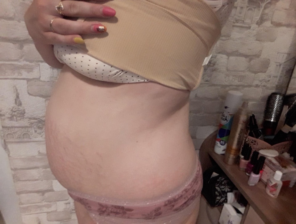 Бандаж пришёл в отличном состоянии, почитав отзывы решила заказать, и правда отличный пояс, хорошо утягивает, не сворачивается, в нём не жарко, и очень удобно, девочки берите не пожалеете, ставлю 5 звёзд👍👍👍