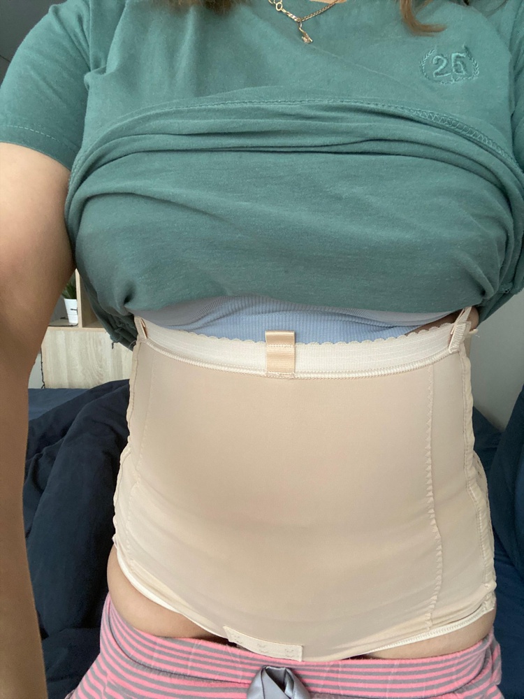 Это бандаж супер как помогает 🙏🏻🙏🏻🙏🏻 пишу на 5-ый день после абдоминопластики. Смогла одеть его сама без помощи, в первый же день после операции). Взяла на размер меньше от своего исходного, компрессия 👍🏻. Огромное спасибо производителю и WB 😊
