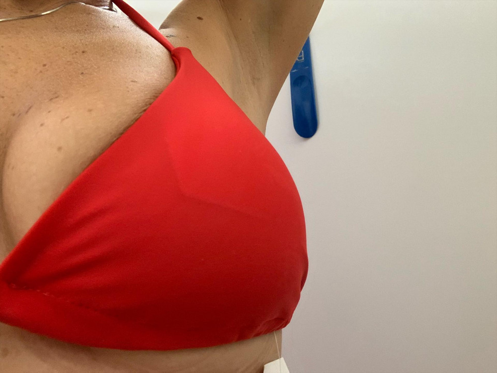 Начиталась хвалебных отзывов и заказала, о чем пожалела. Во-первых, верх НЕ рассчитан на размер больше 2. Я специально заказала 46-48 на свой 80С. Он мал, грудь еле-еле прикрыл, все наружу. Я понимаю, что это бикини, а не топ, но вид комичный🙈 Далее: вкладыши! Я первый раз вижу, чтобы они так просвечивали и выделялись, это жесть, так быть не должно! И без них неуместно - нет поддержки и соски наружу. Единственный плюс - плавки конечно классные, но верх - это просто недоразумение. Еще и за возврат маломерки сняли 50 р. Мелочь и неприятно🥹😩