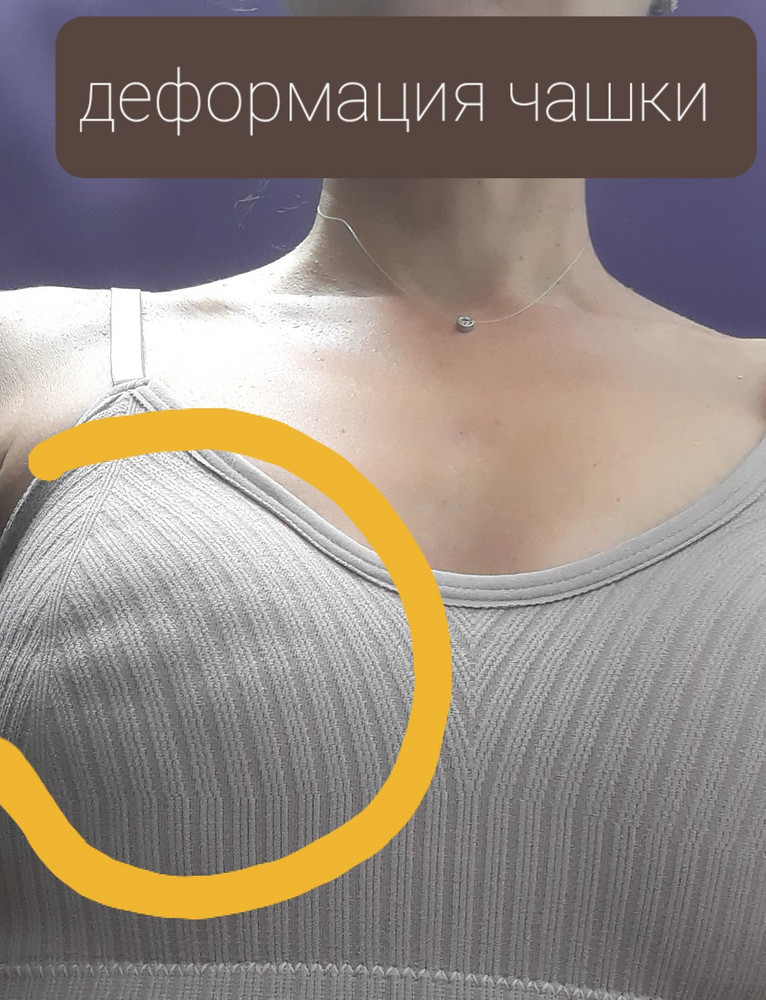 Хороший плотный топ. Но прислали с другими брителями, а деформированная чашка испортила товарный вид. Поэтому отказ. В целом , если товар был бы без брака и четко по заявленной модели - оставила. Но...., увы!