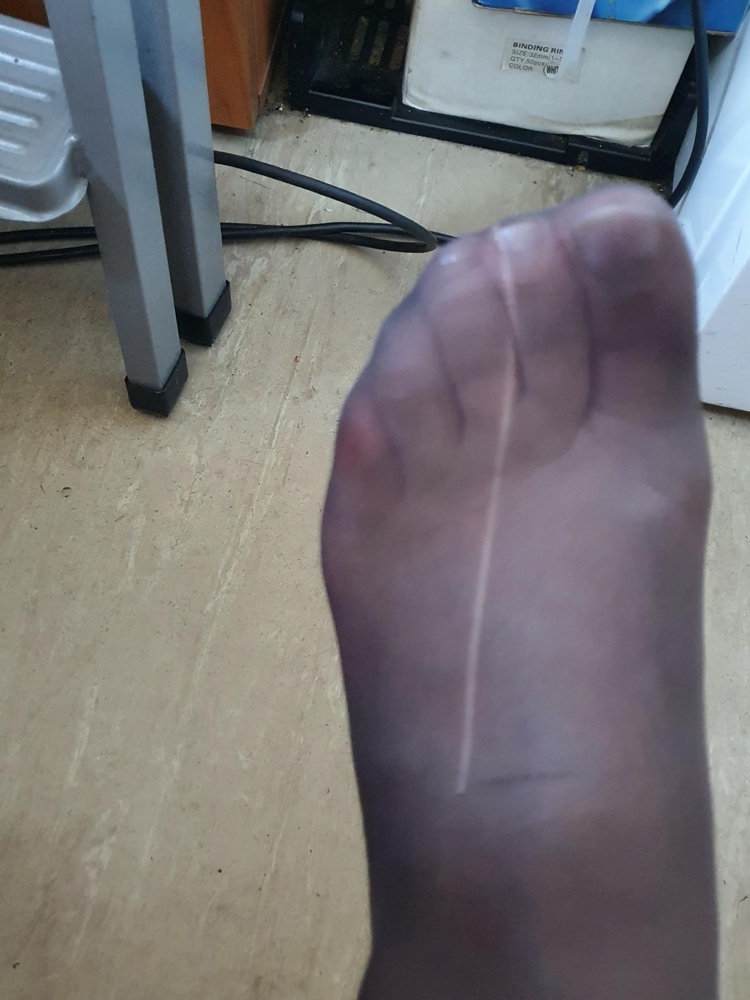 Ктлготки-однодневки. Качестко материала хорошее. Но плохо прошито в номочной части, в результате этого появляется стрелка. На фото   только на работу пришла. И так на всех из набора.