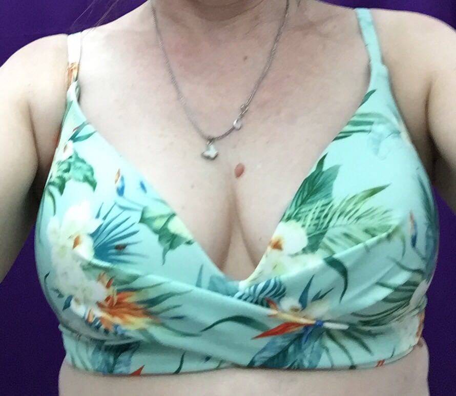 Качественный лиф, идет размер в размер. Ношу 75В,заказывала 75В,75С,особой разницы в чашках нет. Оставила 75С т.к.75В с справой стороны немного торчал, скорее всего нужно было подтянуть бретели. Рекомендую к покупке