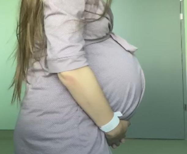 Бандаж начала носить с 7 месяца беременности, очень поддерживал и облегчал движения на последних сроках ) Но мало кто пишет, после беременности, этот бандаж быстро убирает живот. Хорошо поддерживает и после КС - крутой помощник . В нем можно спать и забыть о боли от шрама. Очень круто, рекомендую 