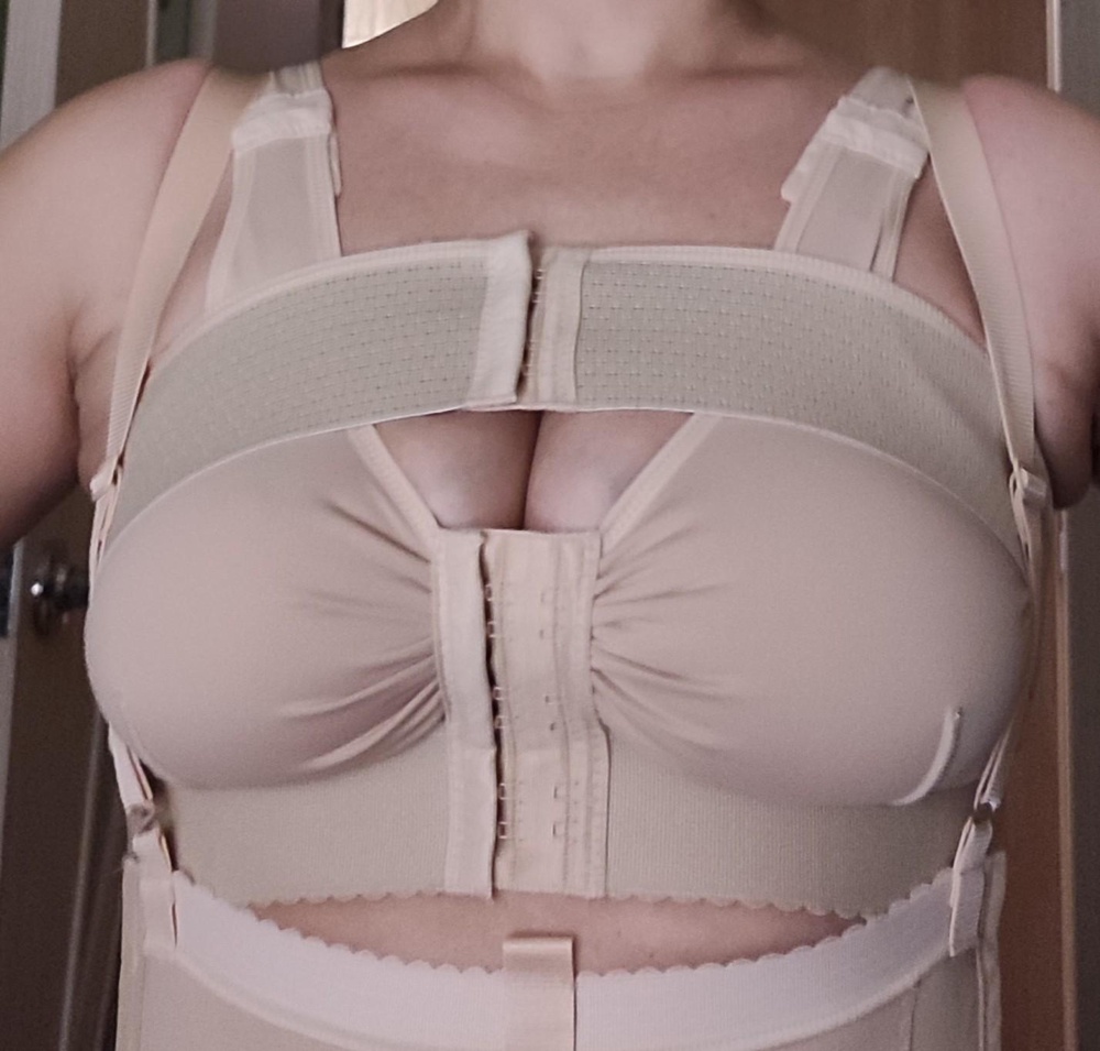 Да здравствует Валберис!!! Спасибо!!! Подбирала размер по отзывам и размерной сетки. Качество на высоте!!! Буду заказывать сменку, суперрр!!! Фотки ДО операции!