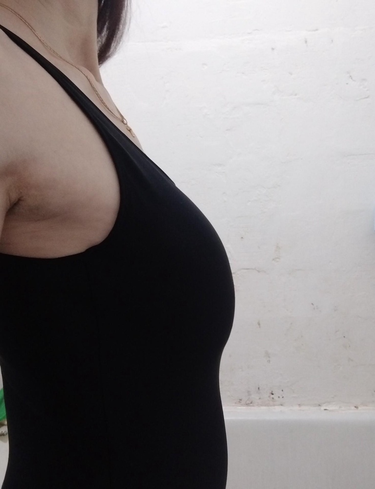 Брала три черных идентичных купальника, но взяла этот. Как показалось в примерочной самый подходящий, хотя был ещё один идеальный, взяла бы два, но он без чашек - отказалась. И тут начала писать отзыв на этот, одела ещё раз чтобы сделать фото и тут разглядела. На свой 46-48 взяла 46, на рост 174 лямки тянет, от этого топорщится на груди. Не смотря на чашки грудь не держит, мою четверку сплющело и сдвунуло к животу, а чашки висят сверху. Не думаю, что 48 решил бы эту проблему, торчали бы подмышки, так как и на 46 немного подмышки торчат. Материал приятный для бассейна подойдёт, а вот на пляж уже не одену, несуразно. Попробовала вытащить чашки, сосок немного видно, но из-за подкладки не так в аналогичном, форма приплюснутой груди не изменилась.. Извиняюсь за фон, дома ремонт. Может вернуть?