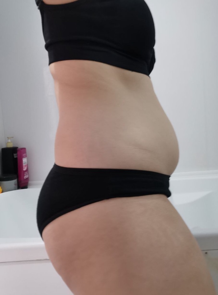 Бандаж супер, утягивает отлично. Липучка качественная, не оставляет катышек на бандаже. Хорошо поддерживает спину, ребенок весь день на руках и поясница не болит. Покупкой довольна как слон😁